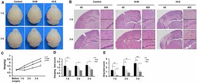 Distinct Residential and Infiltrated Macrophage Populations and Their Phagocytic Function in Mild and Severe Neonatal Hypoxic-Ischemic Brain Damage